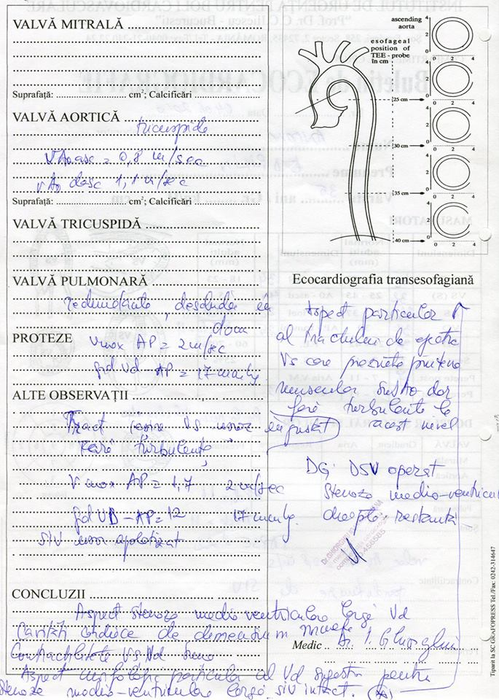 Poetul Fabian Anton are nevoie urgentă de operație la inimă! A apelat la ajutorul oamenilor: „Nu dispun de sumele necesare!”