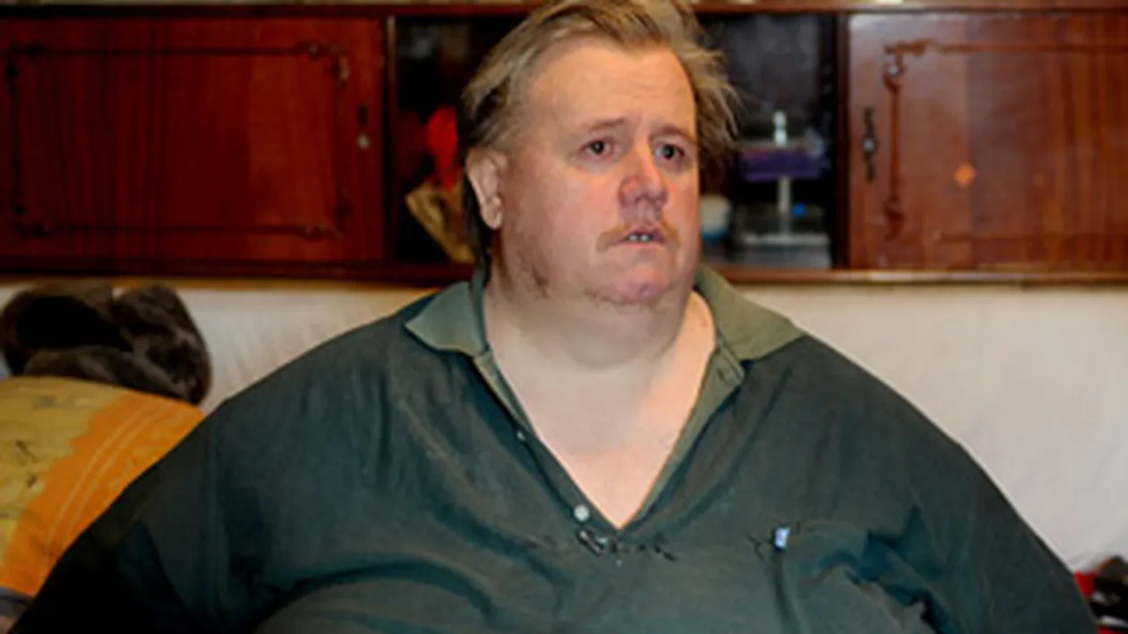 PARADOXAL! Cel mai gras roman sufera de anemie, dupa ce slabit 200 de kilograme