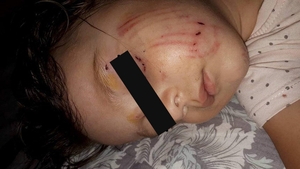 Drama unui copilaş muşcat de faţă de un câine la locul de joacă! Stăpânul animalului s-a făcut nevăzut!