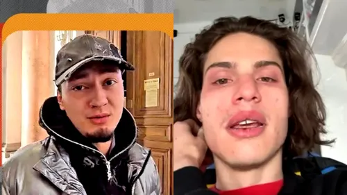 A fost finalizată autopsia lui Rareș Ion. Ce au găsit medicii în trupul tânărului de 20 de ani