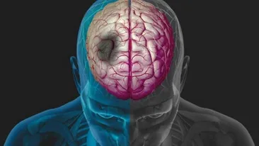 Ce-i omoară pe români? Avertisment din partea unui celebru neurolog