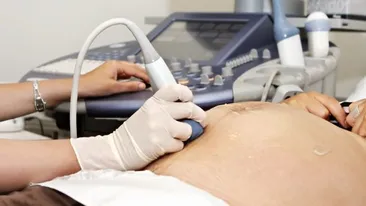 Ce nu are voie să facă o femeie însărcinată. 7 lucruri pe care trebuie să le respecţi