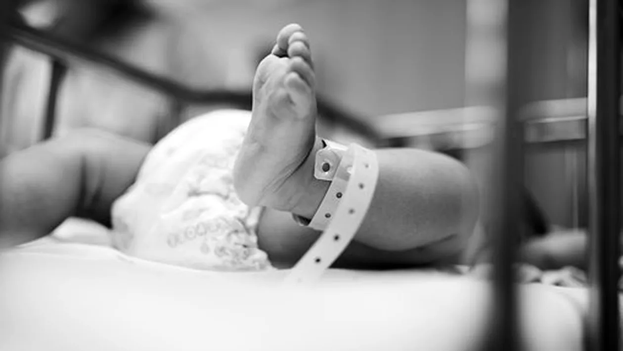 Caz unic în România! Un bebeluș s-a născut cu capul în formă de turn și degetele lipite
