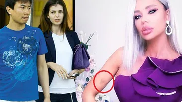 A bătut-o chinezul?! După Bianca Drăgușanu, Monica Gabor șochează și ea. A apărut cu corpul plin de vânătăi