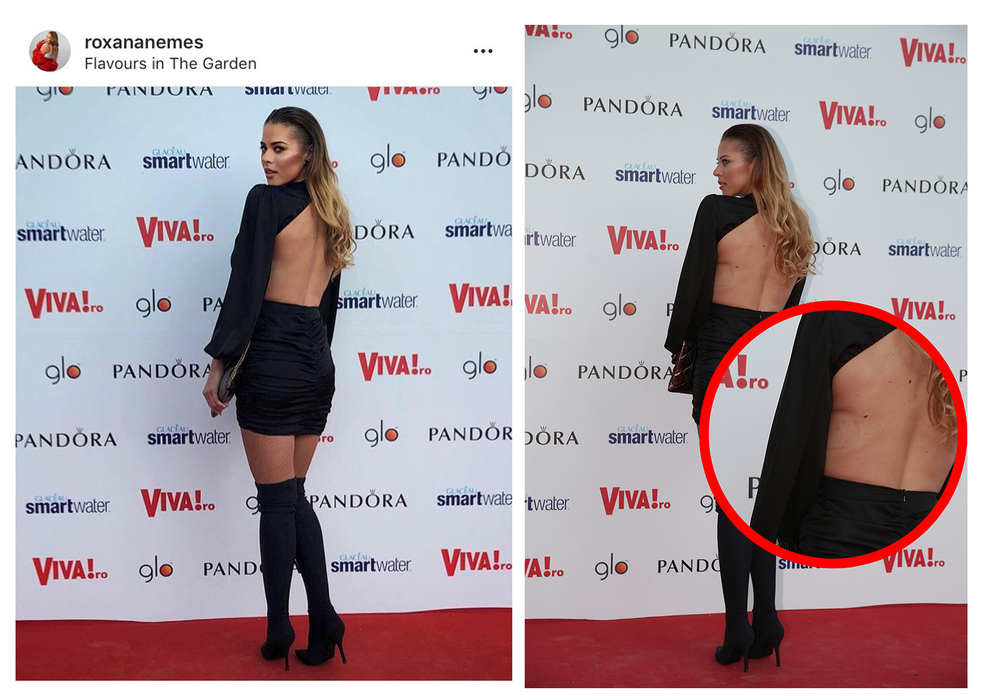 Pe Instagram și-a ”photoshopat” fotografiile, dar în realitate Roxana Nemeș are urmele unei operații