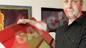 Pictor de geniu dupa operatia pe creier