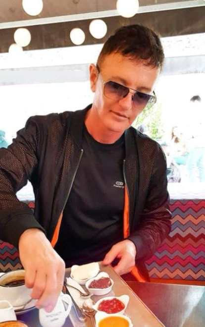 Aurel Moldoveanu este acuzat că ar fi apelat la mai multe intervenții estetice/ sursă foto: social media