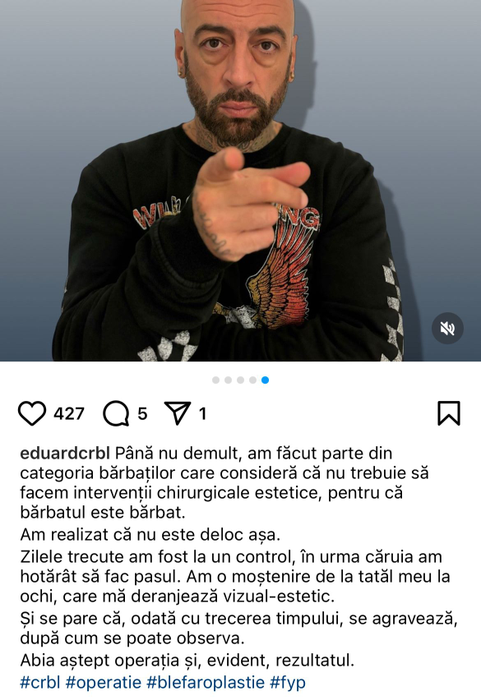 CRBL a decis să își facă o operație estetică. Foto: Instagram / CRBL