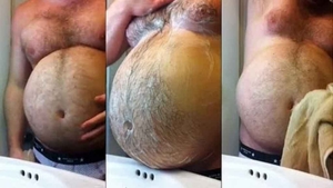 Acest bărbat avea o burta uriașă care îi creștea în fiecare zi. Medicii care l-au operat au rămas înmărmuriți când l-au deschis!