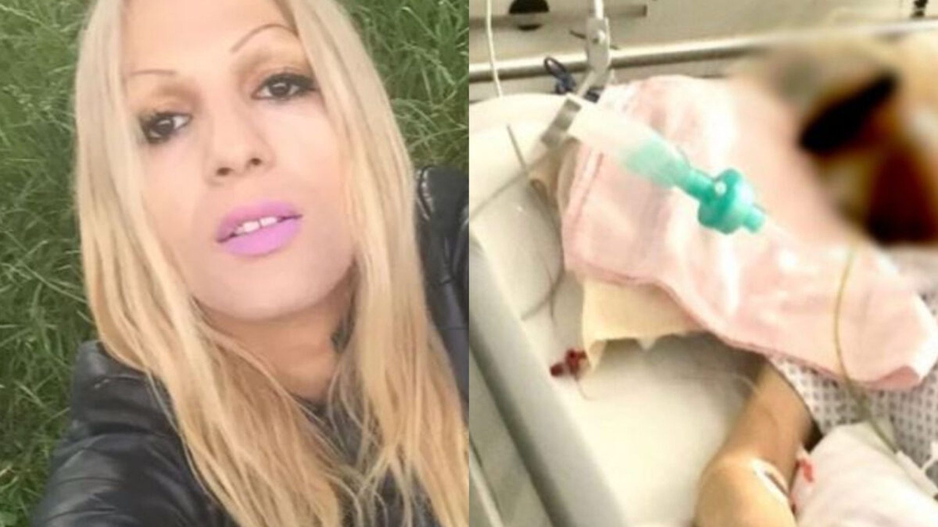 Celebrul transgender Naomi luptă între viață și moarte! Se află în comă, într-un spital din Germania