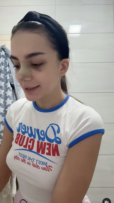Cum arată Daiana Prodan de la Insula Iubirii după operația de rinoplastie. Zici că-i altă persoană!