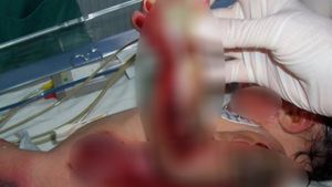Imagini exclusive. Cazul lui a şocat România! Au trecut 8 ani de atunci… Cum arată azi băieţelul ars în incubator la naştere 