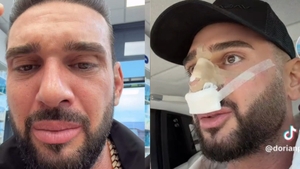 Ce probleme are Dorian Popa după operația la nas. Influencerul a recunoscut: „Nu-l simt așa încă al meu”