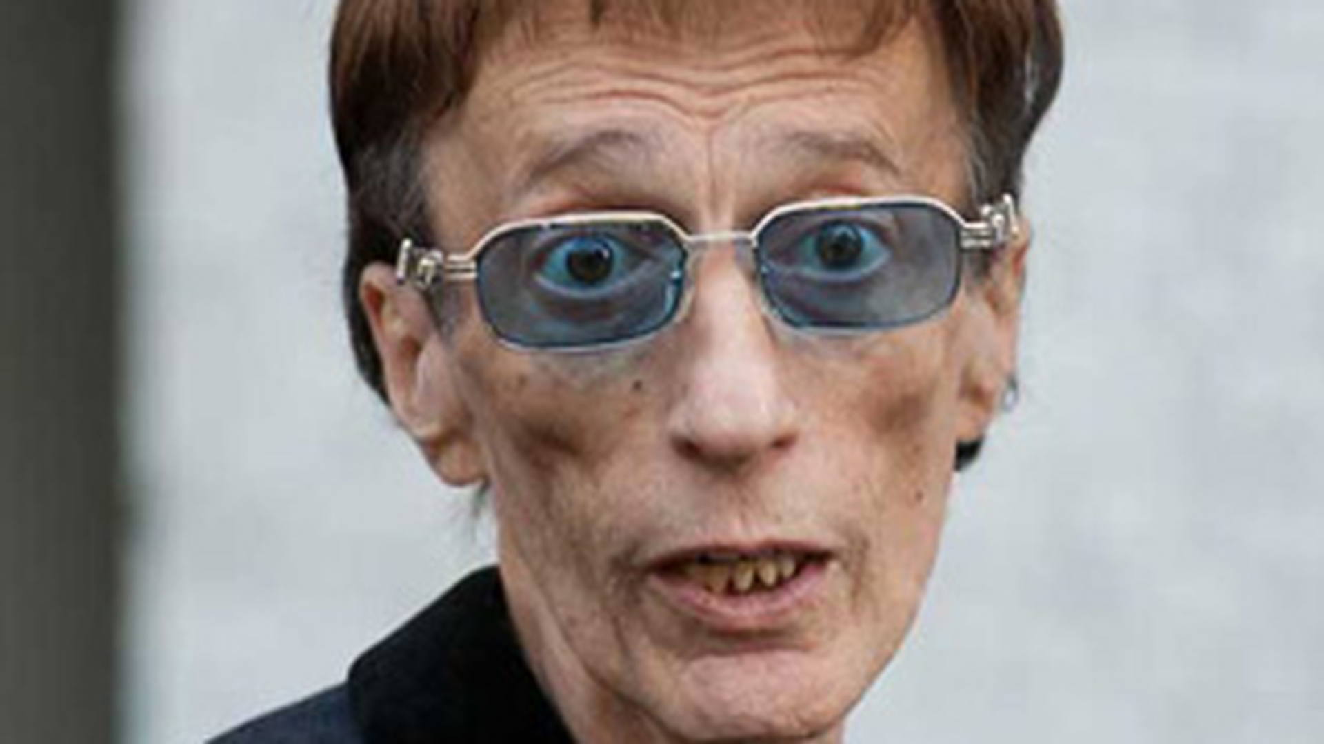 A iesit din coma, desi medicii nu ii mai dadeau sanse sa supravietuiasca! Robin Gibb de la Bee Gees vorbeste dupa zile intregi in care a fost inconstient!