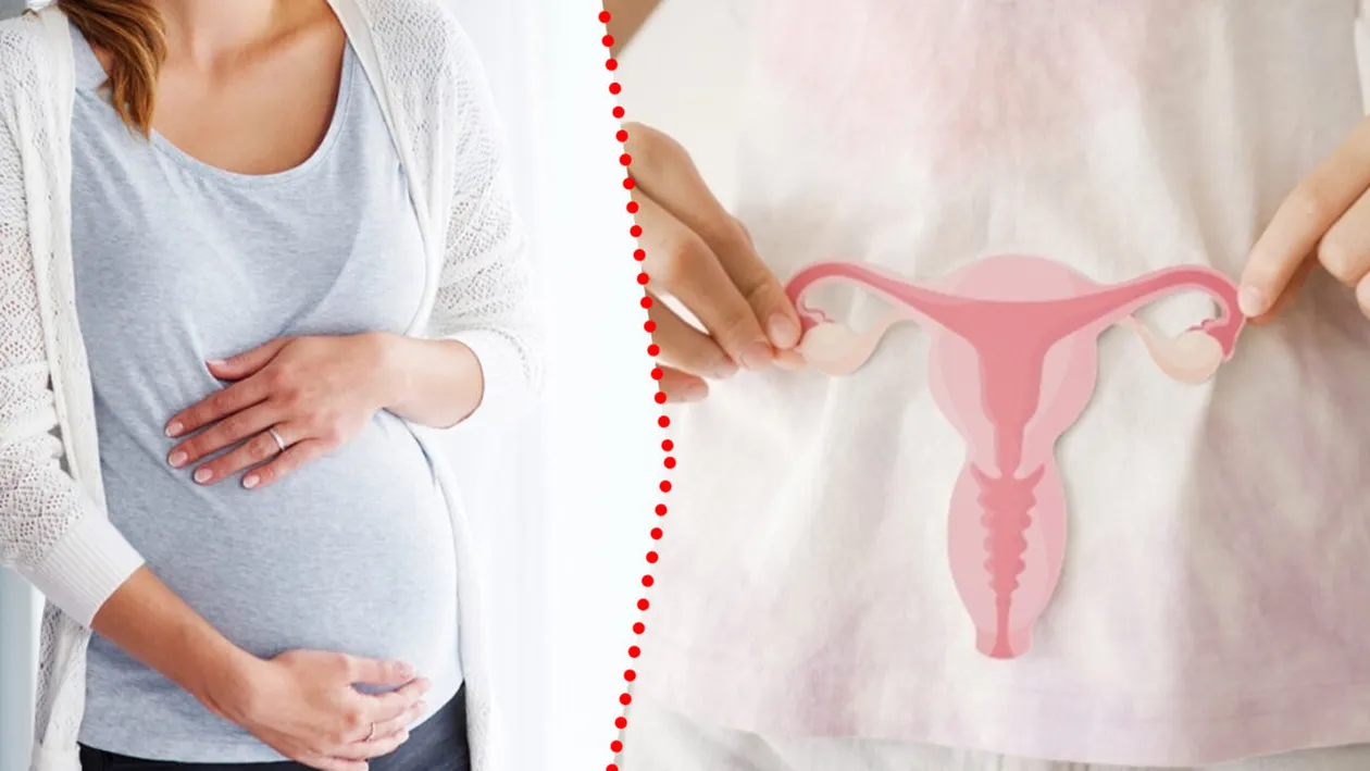 Femeie născută fără uter, însărcinată după ce a primit un transplant de la sora ei. A ajuns în săptămâna 26 de sarcină
