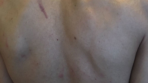 Români terorizaţi în Irlanda. "Am fost omorâţi în bătaie!" Mesaj disperat pentru autorităţi