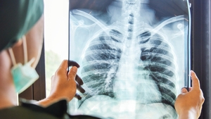 Credea că are o răceală banală și a mers la medic. Incredibil ce diagnostic a primit, de fapt