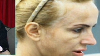 VIDEO Daniela Gyorfi, despre fotografiile in care apare cu fata distrusa: "Oi fi dalmatian si nu imi dau seama!"