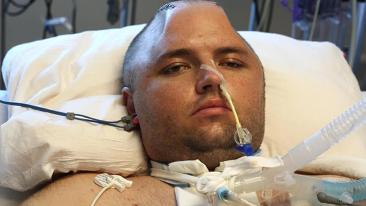 S-a lovit atat de tare incat era sa-i explodeze creierul! Medicii l-au salvat dupa ce i-au bagat capul la frigider