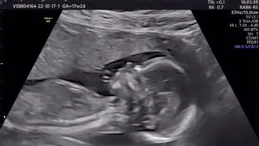 Telespectatorilor nu le-a venit să creadă! Fosta concurentă de la „Insula Iubirii” este însărcinată