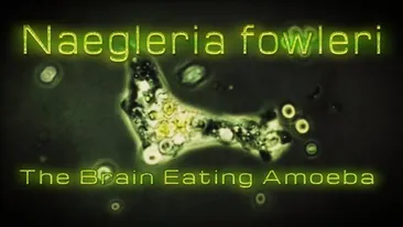 ”Amiba devoratoare de creier” a ucis un bărbat de 29 de ani în SUA. ”Cel mai rău scenariu... ”