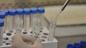 Atentie! Medicii nu recomanda testele rapide de depistare a gripei