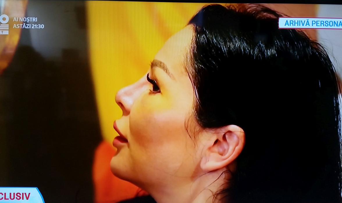 Brigitte le-a arătat tuturor imaginile din sala de operaţie.