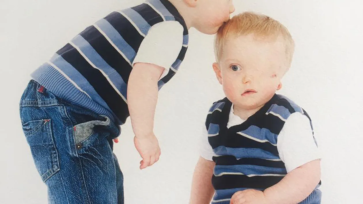 Instagram a şters această fotografie, iar mama micuţului bolnav a luat atitudine! Ce a urmat te va lăsa fără cuvinte: “Ce vedeţi când vă uitaţi la băiatul meu...“