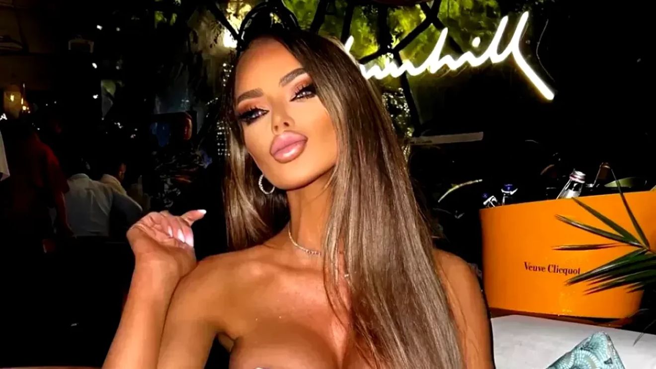 Cum arată Bianca Drăgușanu după intervenția de lip lift. A trecut aproape o lună de când și-a modificat buzele