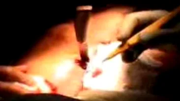 Imagini cutremuratoare! Uite cum se chinuie medicii sa ii scoata cutitul din inima!