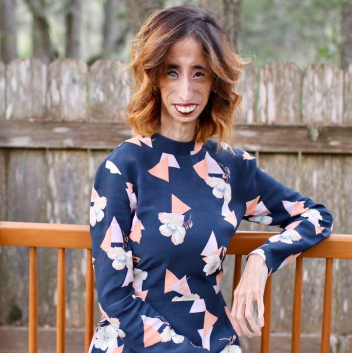 A fost catalogată “cea mai urâtă femeie din lume”, iar acum… Cum arată, în prezent, Lizzie Velasquez