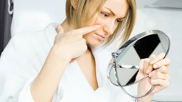 Trucuri simple ca sa scapi de acnee