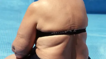 Obezitatea duce la prostie