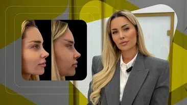 Oana Monea spune adevărul despre operațiile estetice care au scandalizat internetul: Nu mi-am ridicat fața!