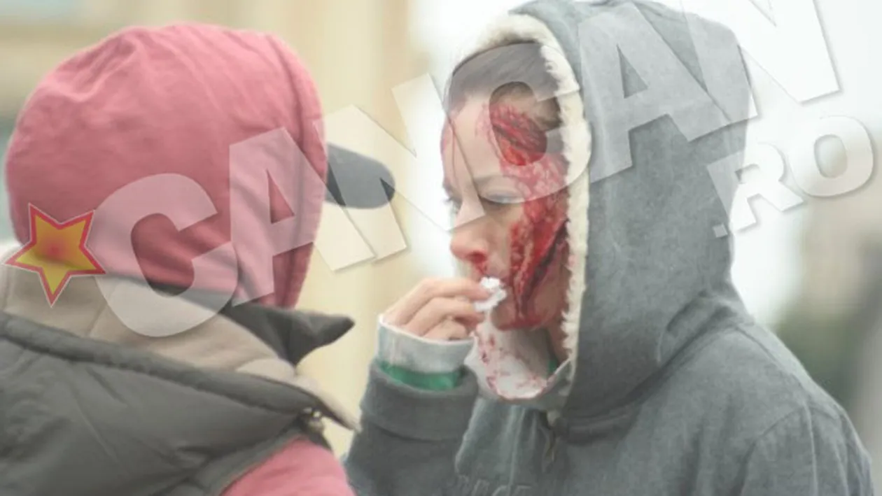 Imagini terifiante cu Laura Cosoi! A iesit in plina strada batuta mar, taiata pe fata si cu sangele curgand siroaie