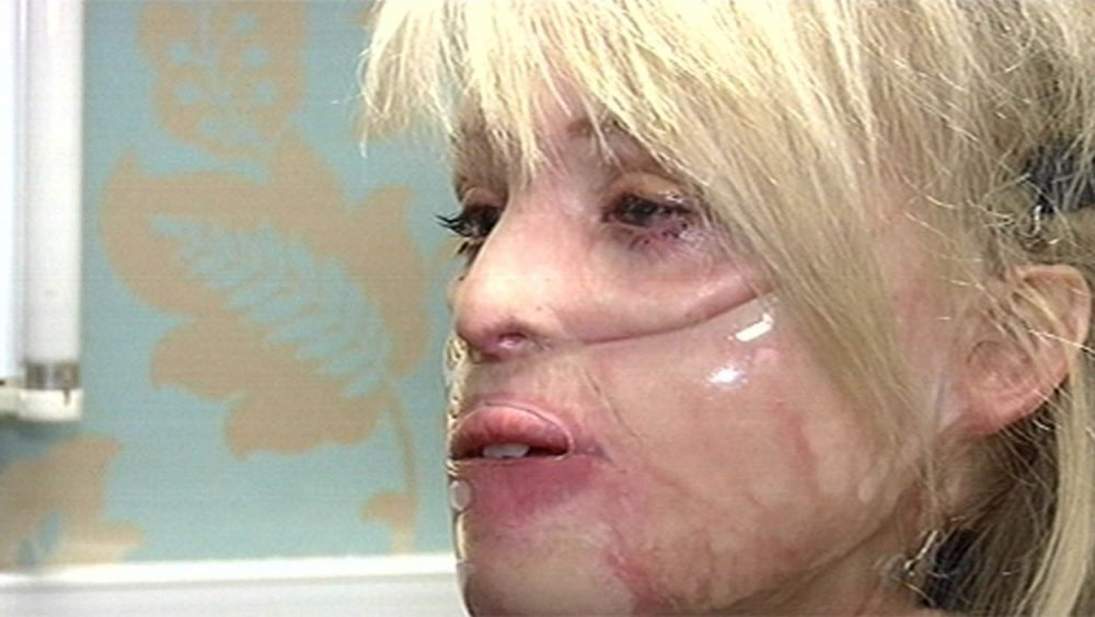 Este o celebră prezentatoare TV, dar în urmă cu 12 ani asta cerea: ”Omorâți-mă!” Drama fostului model, după ce iubitul a desfigurat-o cu acid sulfuric