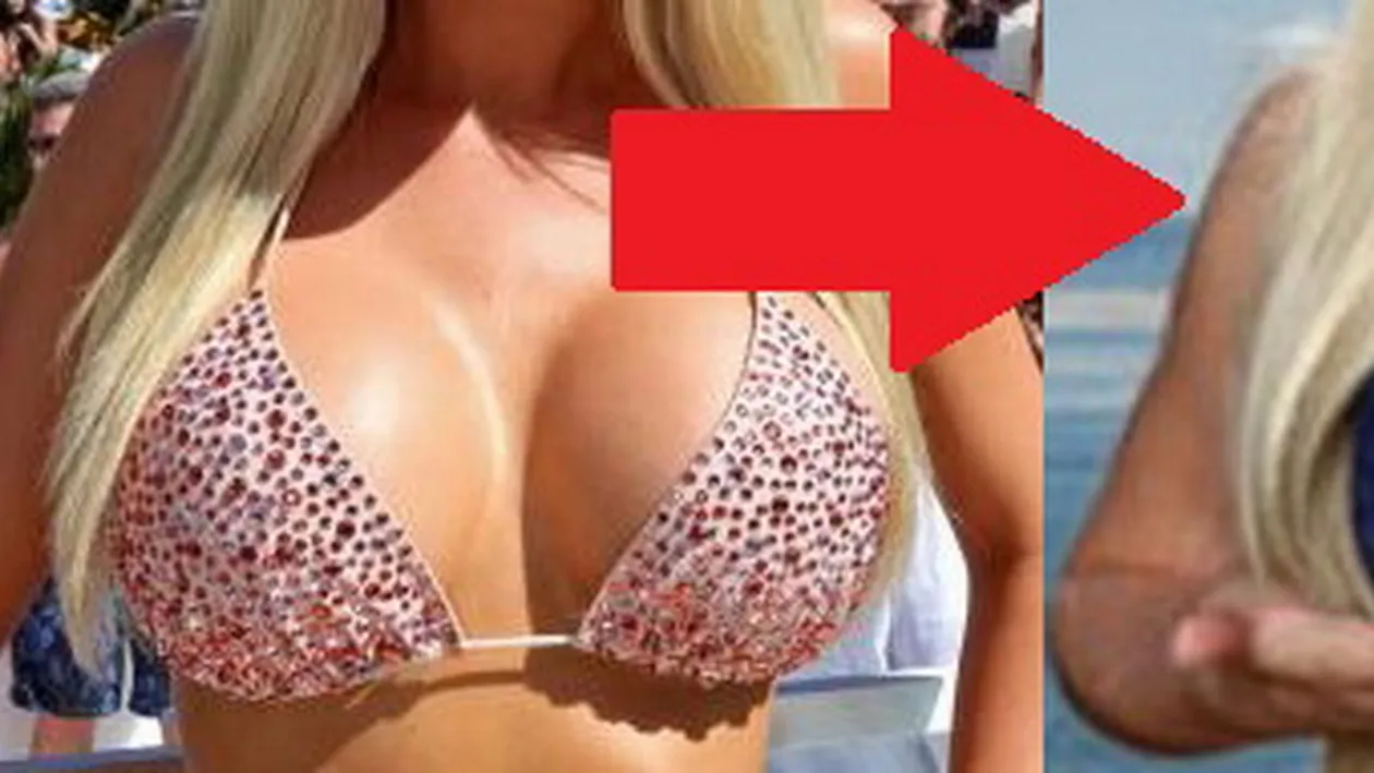 Cum arata dupa ce si-a micsorat sanii! De la cupa F, celebra blonda a trecut la cupa C! Va mai place?