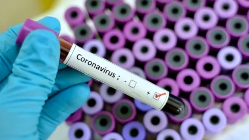 Coronavirus în România. Încă 9 decese anunțate duminică. Bilanțul, 780 de morți