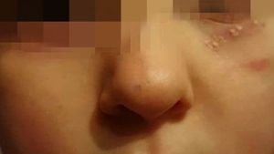 Incident şocant în Vaslui! O educatoare ar fi lovit peste faţă o fetiţă, iar apoi a dat-o cu fond de ten!