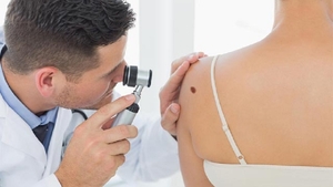 Simptomele cancerului de piele. Cum recunoști primele semne