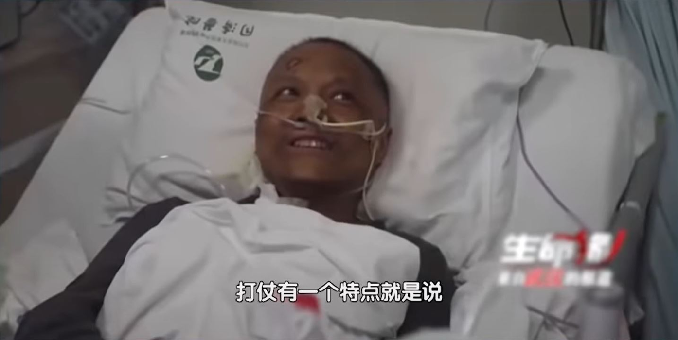 Incredibil! Infectați cu noul coronavirus, doi medici chinezi s-au trezit cu pielea închisă la culoare! Explicațiile specialiștilor
