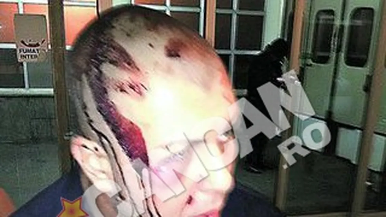 Descinderi pentru o tentativa de omor asupra a doi sportivi comisa in noaptea de Revelion. Interlopul Cherim Ferat, retinut