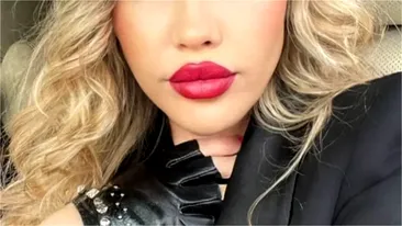 Vedeta din România care a suferit 5 operații în șase ani de chin, după un Hollywood smile: „Am început să fac infecții la rădăcină”