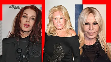 TOP 5- Vedete de la Hollywood care s-au ales cu chipul desfigurat în urma operațiilor estetice. Jocelyn Wildenstein sau Donatella Versace arată de nerecunoscut!