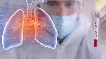 Încă un medic a fost răpus de coronavirus. A plecat din cabinet pe propriile picioare și a ajuns să fie intubat