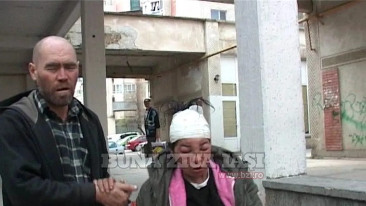 Imagini care te pot afecta emotional! Tulburatorul caz al unei iesence care a baut spirt medicinal doua saptamani incontinuu!