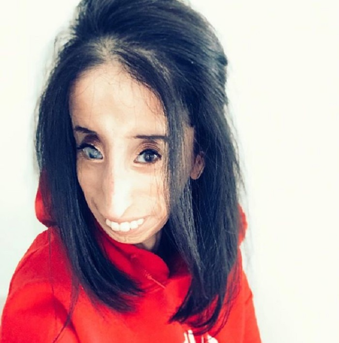 A fost catalogată “cea mai urâtă femeie din lume”, iar acum… Cum arată, în prezent, Lizzie Velasquez