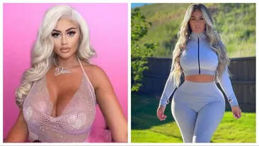 A cheltuit mai mult de 7.000 de lire ca să aibă un posterior perfect. Rezultatul n-a fost însă pe măsura așteptărilor