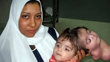 Medicii au rămas fără cuvinte când au văzut ce a născut aceasta femeie! Cazul care a impresionat o lume intreaga