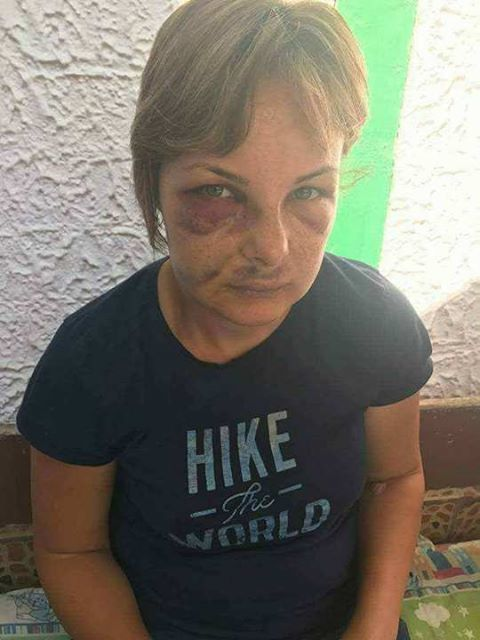 Cristina povesteşte că a fost mutilată la dentist